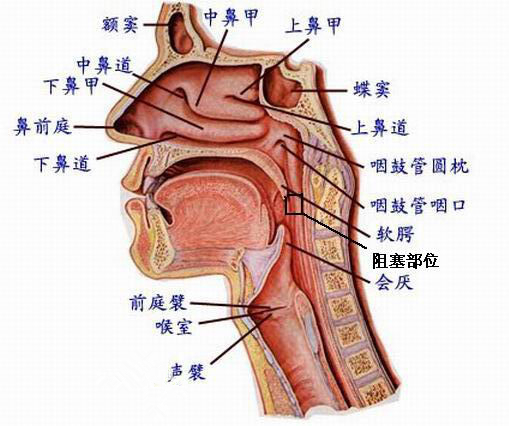 剖析打鼾原因及治疗方法